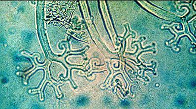 Microsphaera cleistothecium appendages