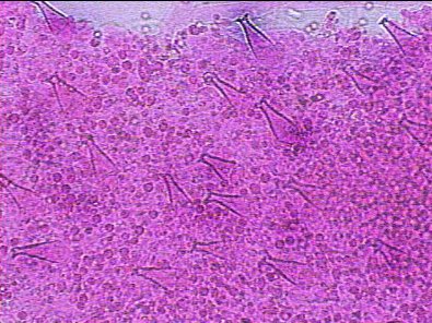 surface of Pluteus cervinus gill showing cystidia