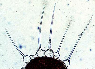 Phyllactinia cleistothecium