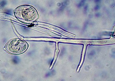 Phytophthora infestans sporangium with knees